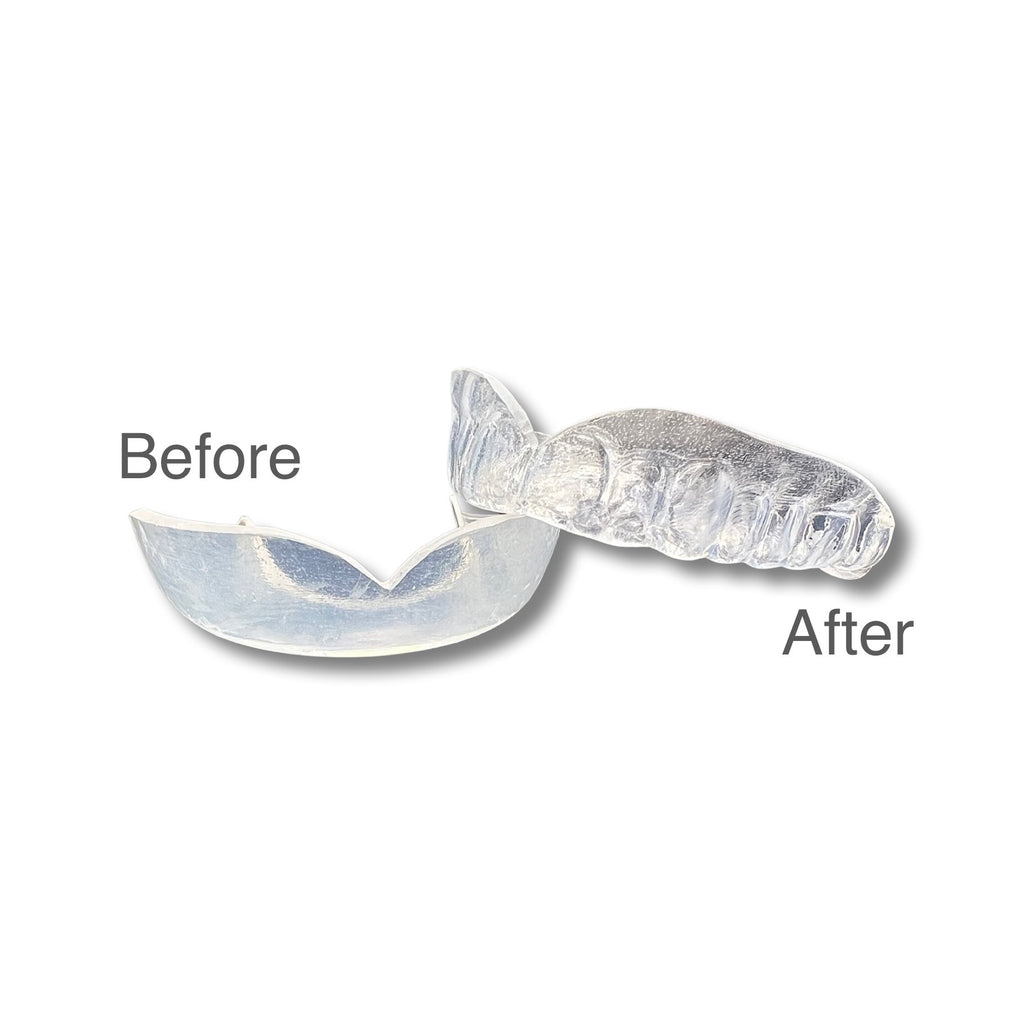 Zero-G is the thinnest, lightest mouthguard available anywhere on the planet. It's SO THIN, you might forget you're wearing it. Zero-G: EXPERIENCE WEIGHTLESSNESS.