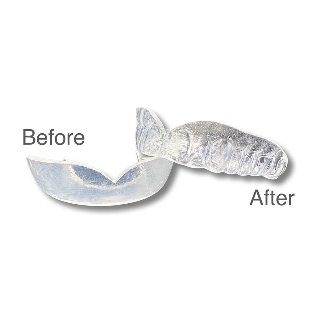 Zero-G Mouthguard (2-Pack)